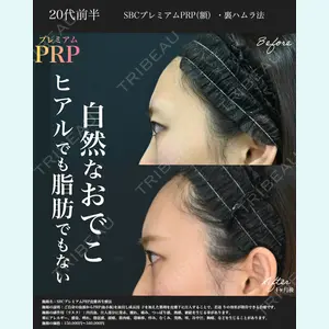 湘南美容クリニック 名古屋院 山本 高士医師の症例
