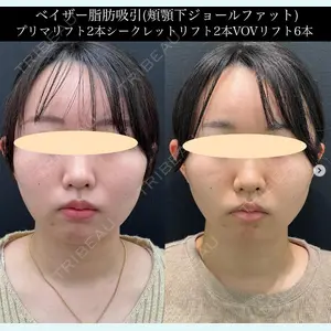 湘南美容クリニック 名古屋駅本院 豊嶋 沙良医師の症例