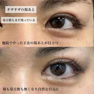 グローバルビューティークリニック 銀座院 理事長　杉崎　裕斗医師の症例
