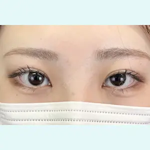 症例