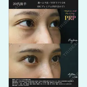 湘南美容クリニック 名古屋院 山本 高士医師の症例