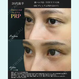 湘南美容クリニック 名古屋院 山本 高士医師の症例