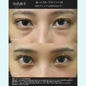湘南美容クリニック 名古屋院 山本 高士医師の症例