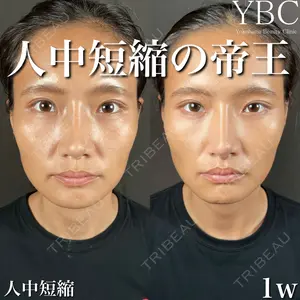 YBC横浜美容外科 大宮院 磯村 亮輔医師の症例