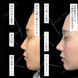 グローバルビューティークリニック 銀座院 理事長　杉崎　裕斗医師の症例