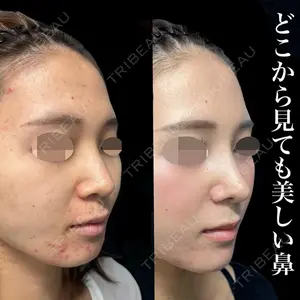 グローバルビューティークリニック 銀座院 理事長　杉崎　裕斗医師の症例
