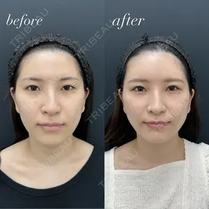 湘南美容クリニック 新横浜院 松田 裕太医師の症例