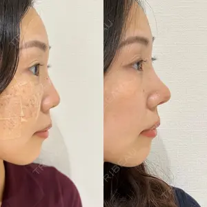 エターナル美容クリニック 久門田 詳医師の症例