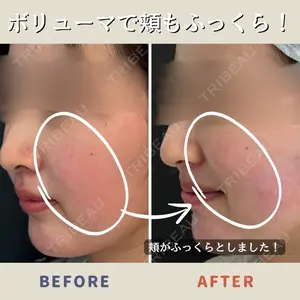 症例