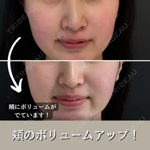 症例