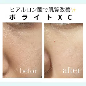 椿クリニック 名古屋院の症例