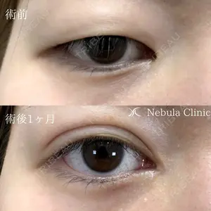 ネビュラクリニック 京都院の症例