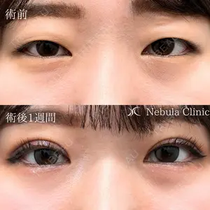 小倉美容外科ネビュラクリニックの症例