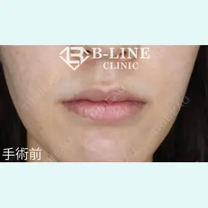 B-LINE CLINIC 池袋院 小池 康弘医師の症例