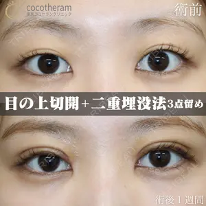 症例