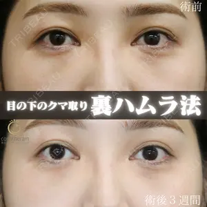 症例