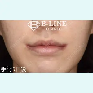 B-LINE CLINIC 池袋院 小池 康弘医師の症例