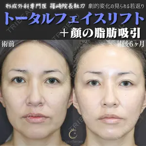 症例
