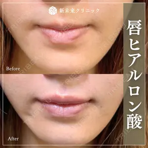 新未来クリニックの症例