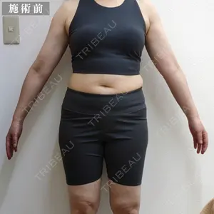 グランジョイクリニック 道上 育子医師の症例