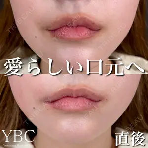 YBC横浜美容外科 立川院の症例