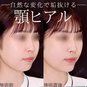 症例