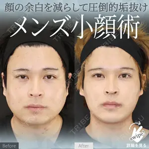 症例