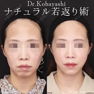 症例