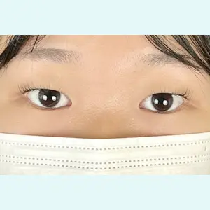 症例