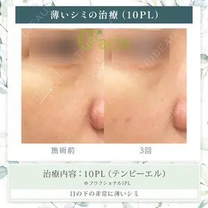 オラクル美容皮膚科 東京新宿院の症例