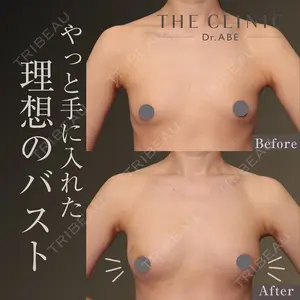 症例