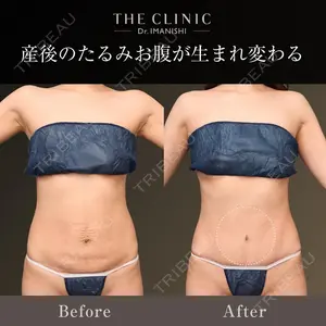 症例