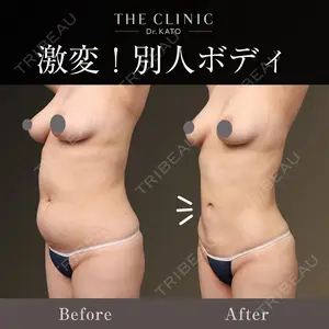 THE CLINIC（ザ・クリニック） 東京院 加藤 敏次医師の症例
