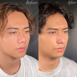 R Beauty CLINIC 銀座院 吉田　慧医師の症例