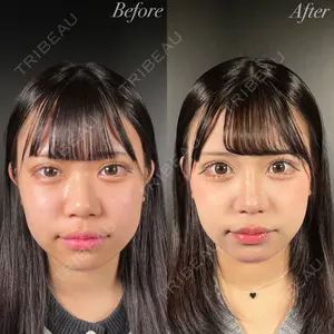 R Beauty CLINIC 銀座院 吉田　慧医師の症例