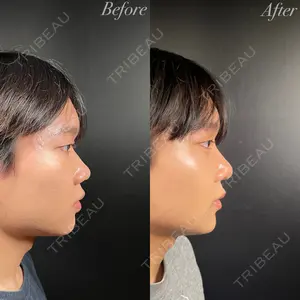 R Beauty CLINIC 銀座院 吉田　慧医師の症例