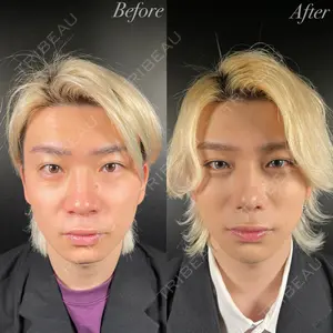 R Beauty CLINIC 銀座院 吉田　慧医師の症例