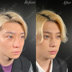 R Beauty CLINIC 銀座院 吉田　慧医師の症例