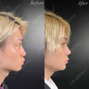R Beauty CLINIC 銀座院 吉田　慧医師の症例