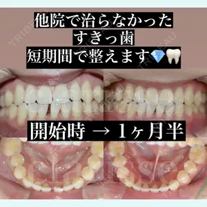症例