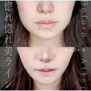 症例