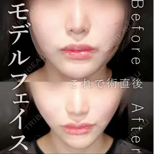 症例