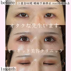 オーキッド美容クリニック東京御徒町 西浦 蘭子医師の症例