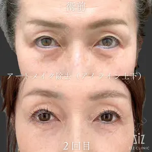 ziz CLINIC 村岡 史子医師の症例