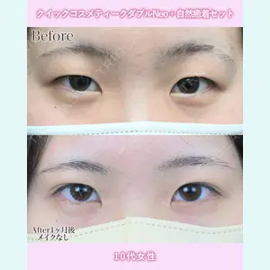 湘南美容クリニック 名古屋院 山本 高士医師の症例