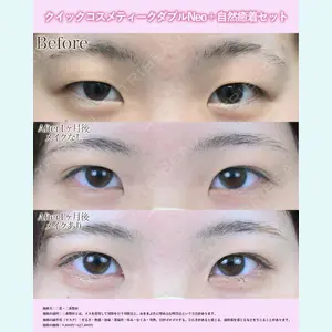 湘南美容クリニック 名古屋院 山本 高士医師の症例