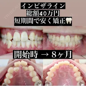 症例