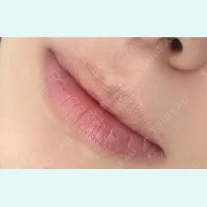 しんゆり美容健康クリニックの症例