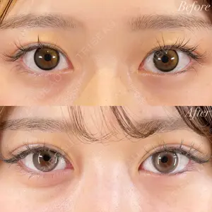 R Beauty CLINIC 銀座院 富田 莉沙子医師の症例