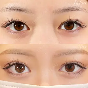 R Beauty CLINIC 銀座院 富田 莉沙子医師の症例